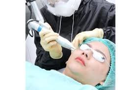 Laser pigmentation treatment Singapore